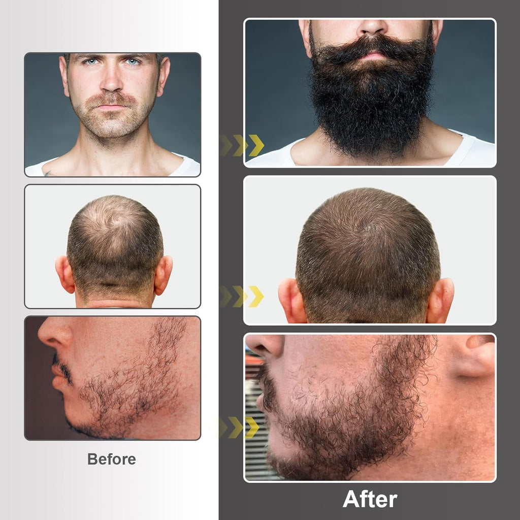 Beard Growth Kit with Beard Growth Oil (2 oz), Beard Balm and Comb A2266