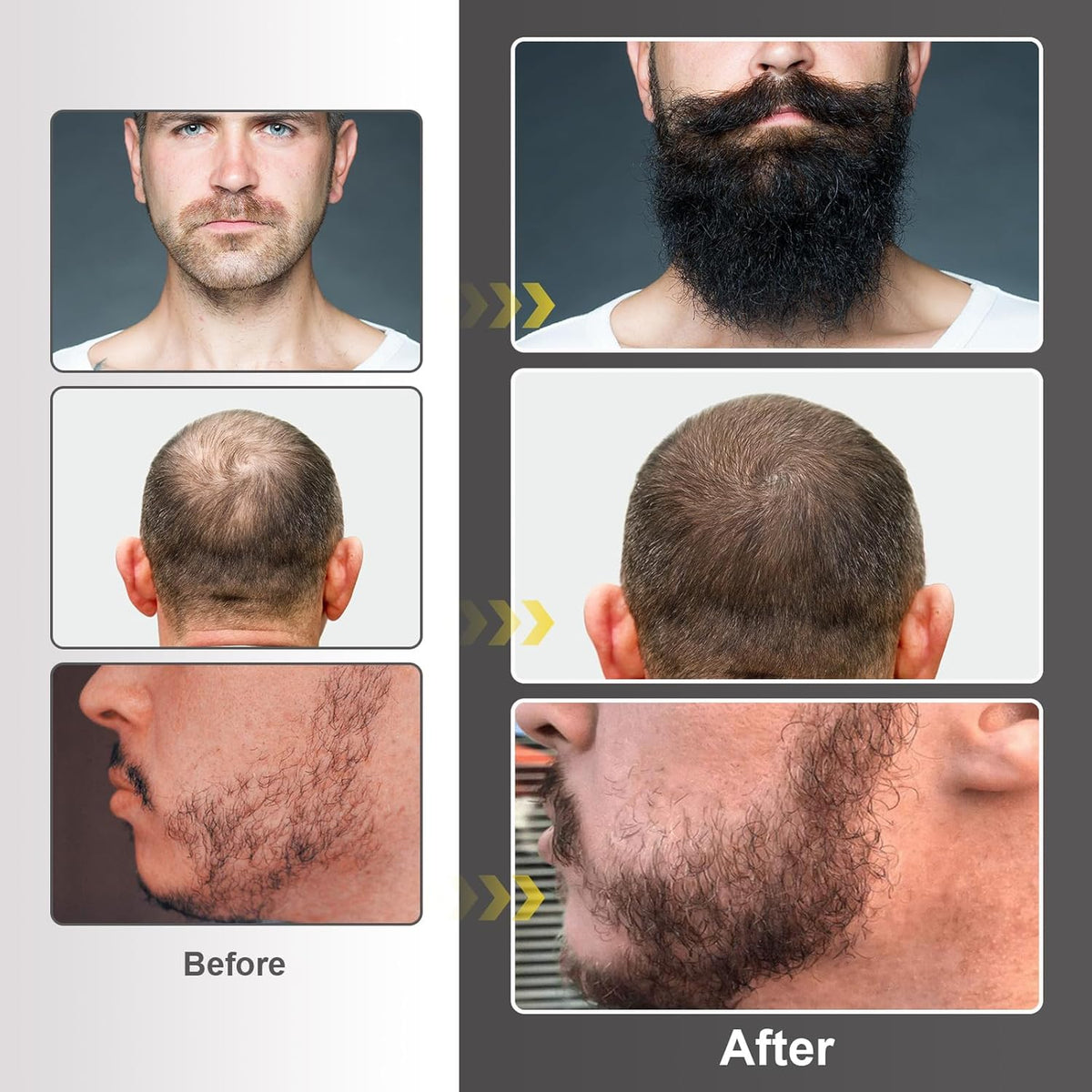 Beard Growth Kit with Beard Growth Oil (2 oz), Beard Balm and Comb A2266